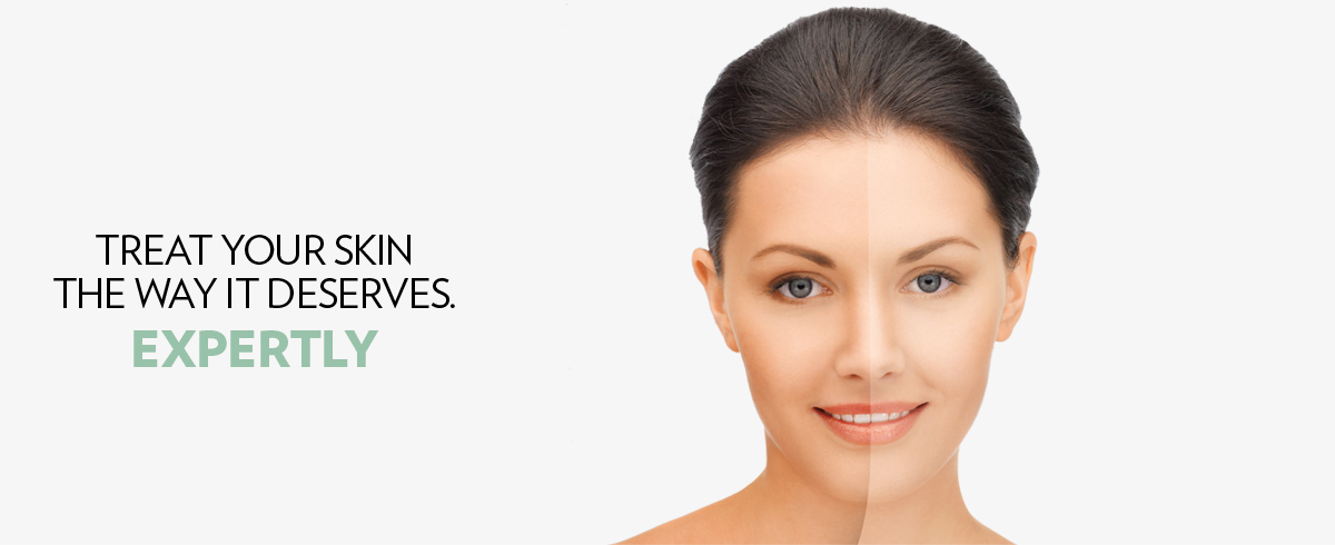 Skin Brightening Treatment in Johannesburg