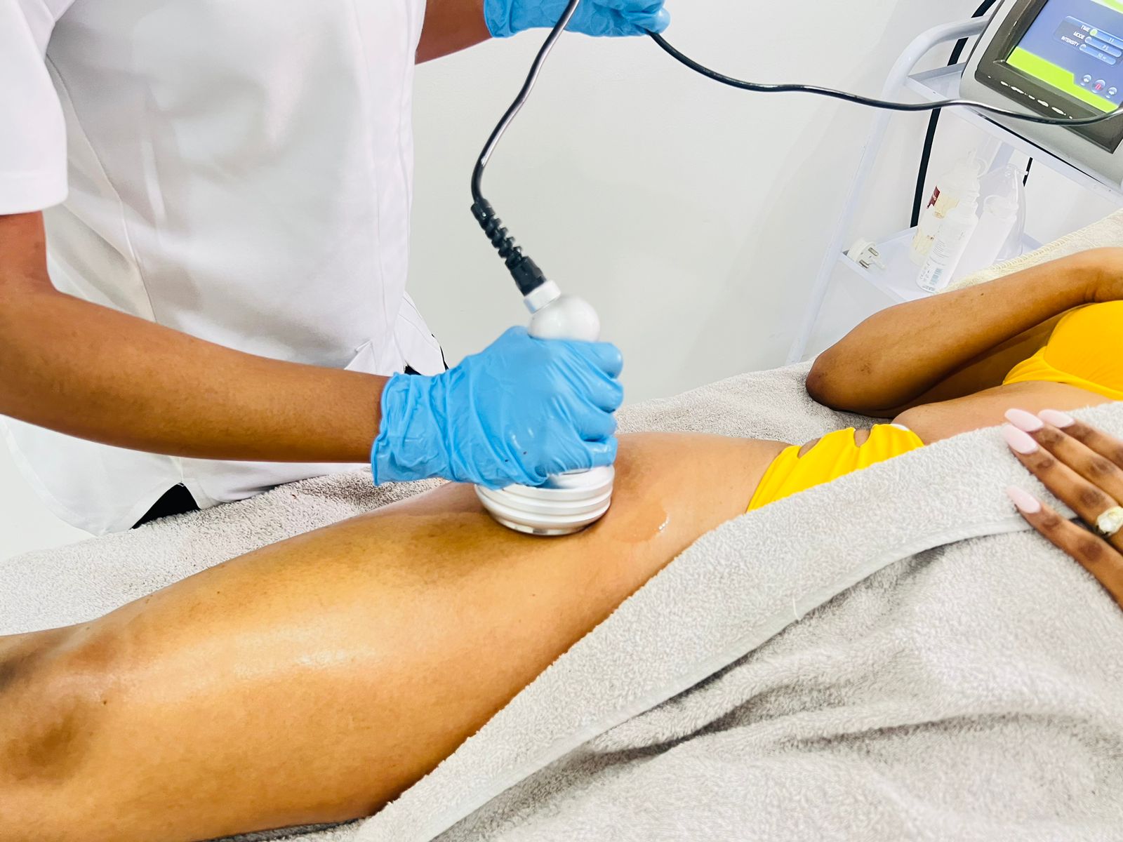 a lady getting micro-needling